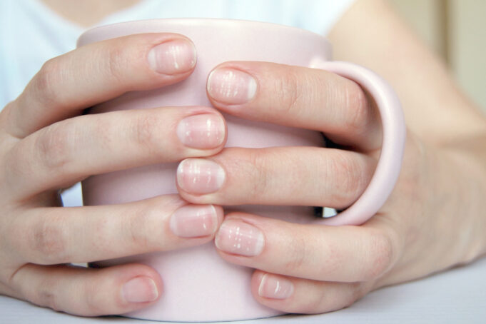 D’où viennent les tâches blanches sur les ongles ?