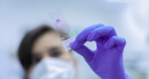 Cette bactérie qui circule en France inquiète les médecins