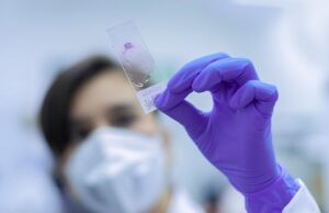 Cette bactérie qui circule en France inquiète les médecins