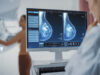 Cancer du sein : ce qui va changer