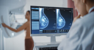 Cancer du sein : ce qui va changer