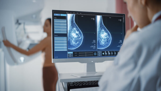 Cancer du sein : ce qui va changer