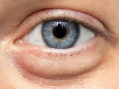 Poches sous les yeux : comment s’en débarrasser ?