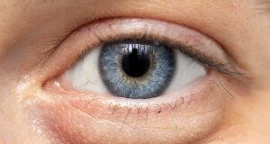 Poches sous les yeux : comment s’en débarrasser ?