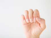 Cancer de la peau : comment reconnaître un mélanome sous l’ongle ?