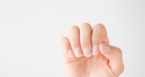 Cancer de la peau : comment reconnaître un mélanome sous l’ongle ?