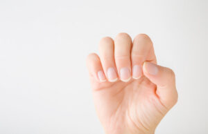 Cancer de la peau : comment reconnaître un mélanome sous l’ongle ?