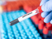 Diphtérie en France : l’augmentation des cas est inquiétante