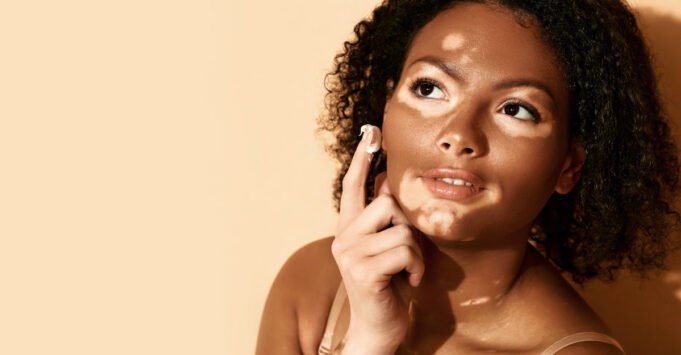 Peau : un traitement prometteur contre le vitiligo