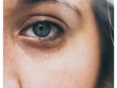 Pourquoi a-t-on des cernes quand on est fatigué ?
