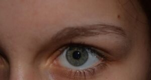 Quand s’inquiéter de ses grains de beauté ?