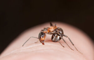 Piqûre de fourmi : comment la soigner ?