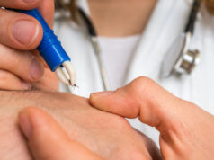 Maladie de Lyme : quels sont les premiers signes ?