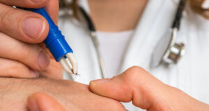 Maladie de Lyme : quels sont les premiers signes ?