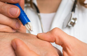 Maladie de Lyme : quels sont les premiers signes ?