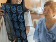 Mini AVC : Ces signes que vous ne devez pas négliger