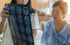 Mini AVC : Ces signes que vous ne devez pas négliger