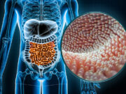 4 mauvais aliments pour votre microbiote