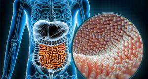 4 mauvais aliments pour votre microbiote