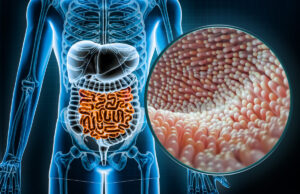 4 mauvais aliments pour votre microbiote