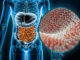 4 mauvais aliments pour votre microbiote