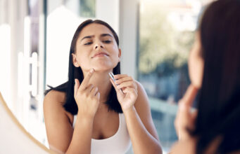 Poils au menton : comment s’en débarrasser