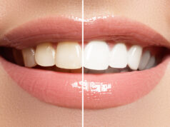 Ces 7 aliments à éviter pour garder les dents blanches