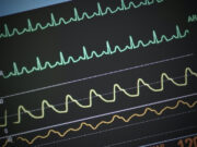 Quelles sont ces 5 maladies qui peuvent provoquer le décès en seulement 24 heures ?