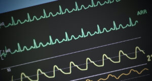 Quelles sont ces 5 maladies qui peuvent provoquer le décès en seulement 24 heures ?