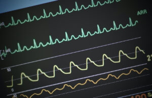 Quelles sont ces 5 maladies qui peuvent provoquer le décès en seulement 24 heures ?