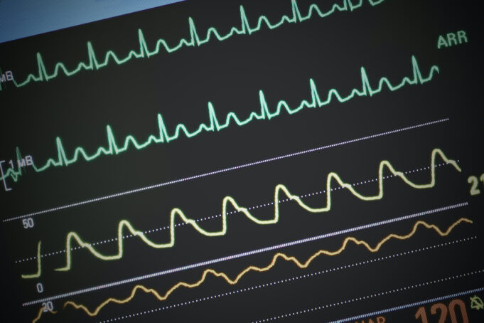 Quelles sont ces 5 maladies qui peuvent provoquer le décès en seulement 24 heures ?