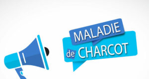 Maladie de Charcot : quels sont les signes ?