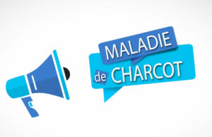 Maladie de Charcot : quels sont les signes ?