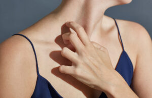 Allergie au soleil : ces symptômes à ne pas négliger