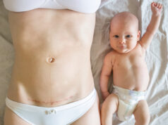 Naissance : quel est l’effet de la césarienne sur le microbiote de bébé ?