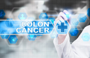 Dépistage des cancers : une nouvelle étude mesure la participation des Français