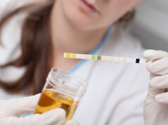 Ce que la couleur de vos urines révèle sur votre santé : décryptage étonnant et instructif
