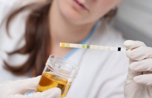 Ce que la couleur de vos urines révèle sur votre santé : décryptage étonnant et instructif