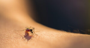 Prévenir les piqûres d’insectes : ce que vous devez mettre dans votre trousse à pharmacie