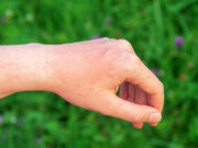 Médicaments et chaleur : attention aux réactions possibles