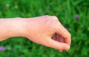 Médicaments et chaleur : attention aux réactions possibles