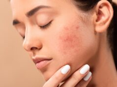 Ces 6 aliments sont mauvais pour la peau, évitez les
