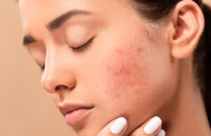 Ces 6 aliments sont mauvais pour la peau, évitez les