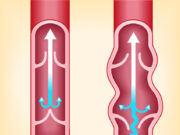 Jambes lourdes : évitez ces 5 aliments pour les soulager