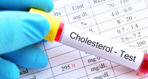 5 plantes médicinales pour lutter contre le cholestérol