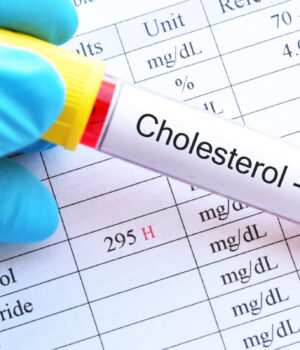 5 plantes médicinales pour lutter contre le cholestérol