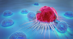 Les signes précurseurs indiquant la survenue d’un cancer