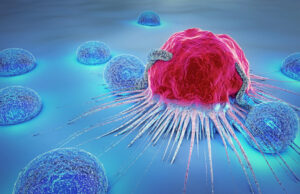 Les signes précurseurs indiquant la survenue d’un cancer