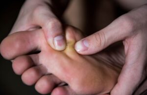 5 remèdes naturels pour soigner les cors aux pieds douloureux