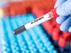 Alzheimer : le sang menstruel pourrait aider à traiter la maladie selon une étude